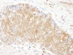 CCT3 Polyclonal Antibody