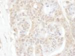 ROC1 Polyclonal Antibody