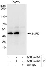SORD Polyclonal Antibody
