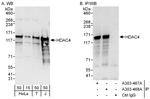HDAC4 Polyclonal Antibody