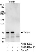 Toca-1 Polyclonal Antibody