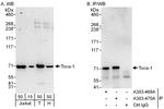Toca-1 Antibody in Western Blot (WB)