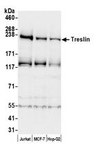 Treslin Polyclonal Antibody