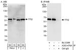 TTI2 Polyclonal Antibody