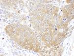 CCT5 Antibody in Immunohistochemistry (Paraffin) (IHC (P))