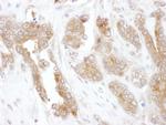 CCT5 Polyclonal Antibody