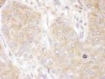 DCTN2 Polyclonal Antibody