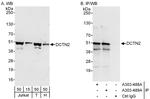 DCTN2 Antibody in Western Blot (WB)