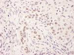 GR Polyclonal Antibody