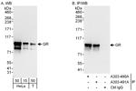 GR Antibody in Western Blot (WB)