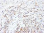 STAT5a Antibody in Immunohistochemistry (Paraffin) (IHC (P))