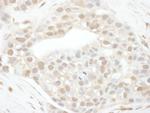 Cyclin T1 Polyclonal Antibody