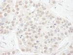 Cyclin T1 Polyclonal Antibody