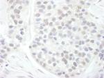 Cyclin T1 Polyclonal Antibody