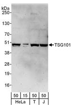 TSG101 Polyclonal Antibody