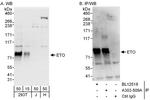 ETO Antibody in Western Blot (WB)