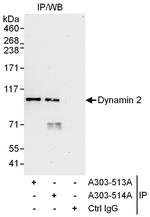 Dynamin 2 Antibody in Immunoprecipitation (IP)