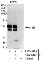 c-Ski Polyclonal Antibody