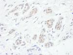 FOXC1 Polyclonal Antibody