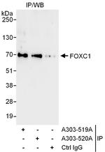 FOXC1 Antibody in Immunoprecipitation (IP)