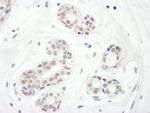 FOXC1 Polyclonal Antibody