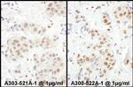 MEF2D Polyclonal Antibody