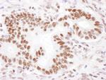 PABPN1 Polyclonal Antibody