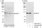 VPS11 Polyclonal Antibody