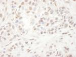 ELK1 Antibody in Immunohistochemistry (Paraffin) (IHC (P))