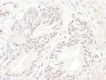 ELK1 Polyclonal Antibody