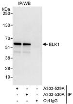 ELK1 Antibody in Immunoprecipitation (IP)