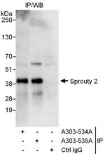 Sprouty 2 Polyclonal Antibody