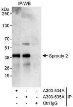 Sprouty 2 Polyclonal Antibody
