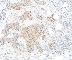 TBP1 Polyclonal Antibody