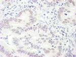 EDD1 Polyclonal Antibody