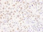 USF2 Polyclonal Antibody