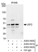 USF2 Antibody in Immunoprecipitation (IP)
