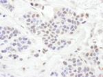 TLE1 Polyclonal Antibody