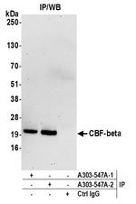 CBF-beta Polyclonal Antibody