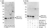CBF-beta (isoform 2) Polyclonal Antibody