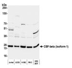 CBF-beta (isoform 1) Polyclonal Antibody