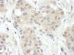 FIH-1 Polyclonal Antibody