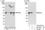 RING1 Antibody in Western Blot (WB)