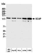 SCAP Polyclonal Antibody