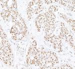 PARN Polyclonal Antibody