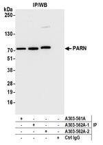 PARN Antibody in Immunoprecipitation (IP)