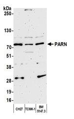 PARN Antibody in Western Blot (WB)