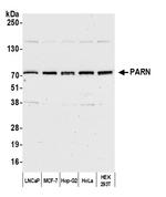 PARN Antibody in Western Blot (WB)