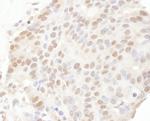 TRPS1 Polyclonal Antibody