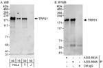 TRPS1 Antibody in Western Blot (WB)